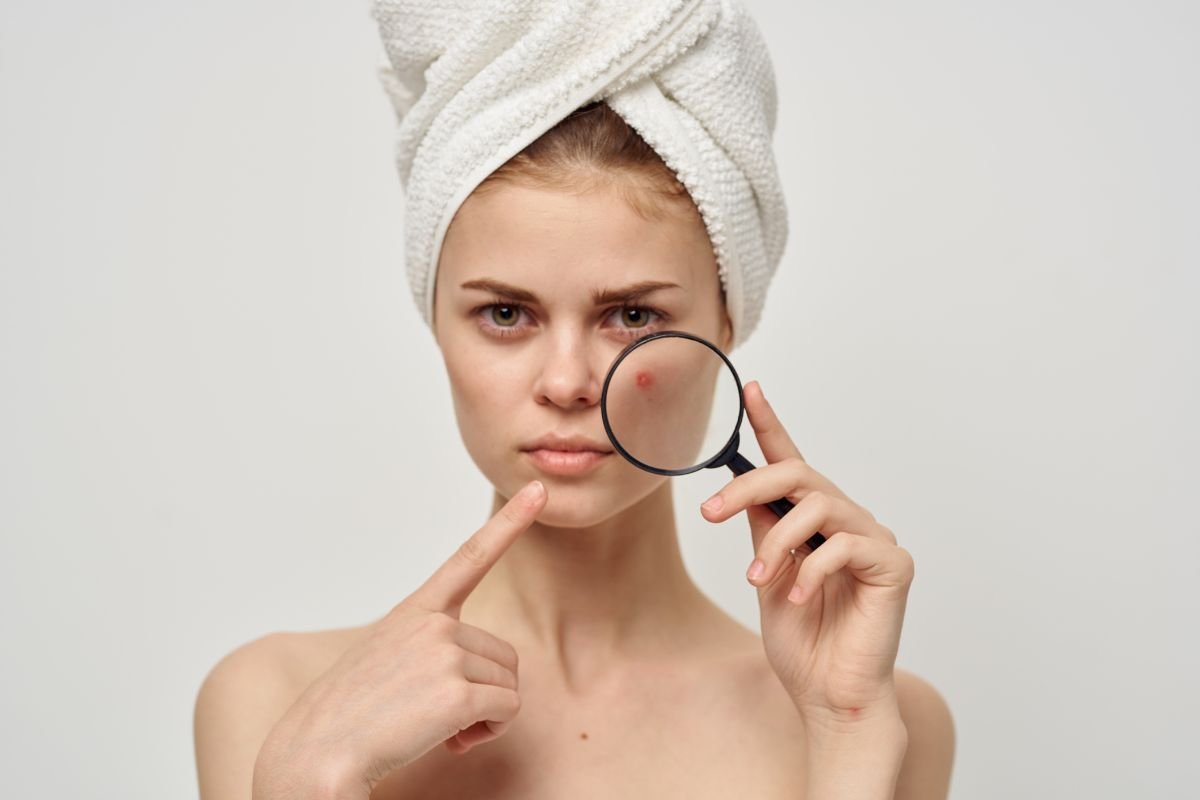 Best Facials for Acne-Prone Skin
