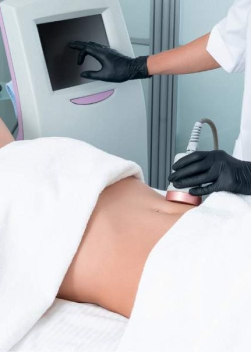 Benefit from Body Contouring