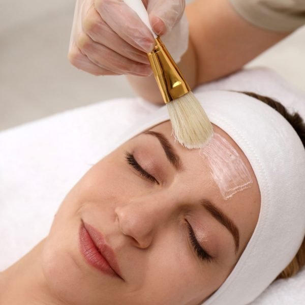 Chemical Peels for Wrinkles